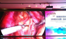 妇科手术视频大全,全面解析各类妇科手术技巧与流程